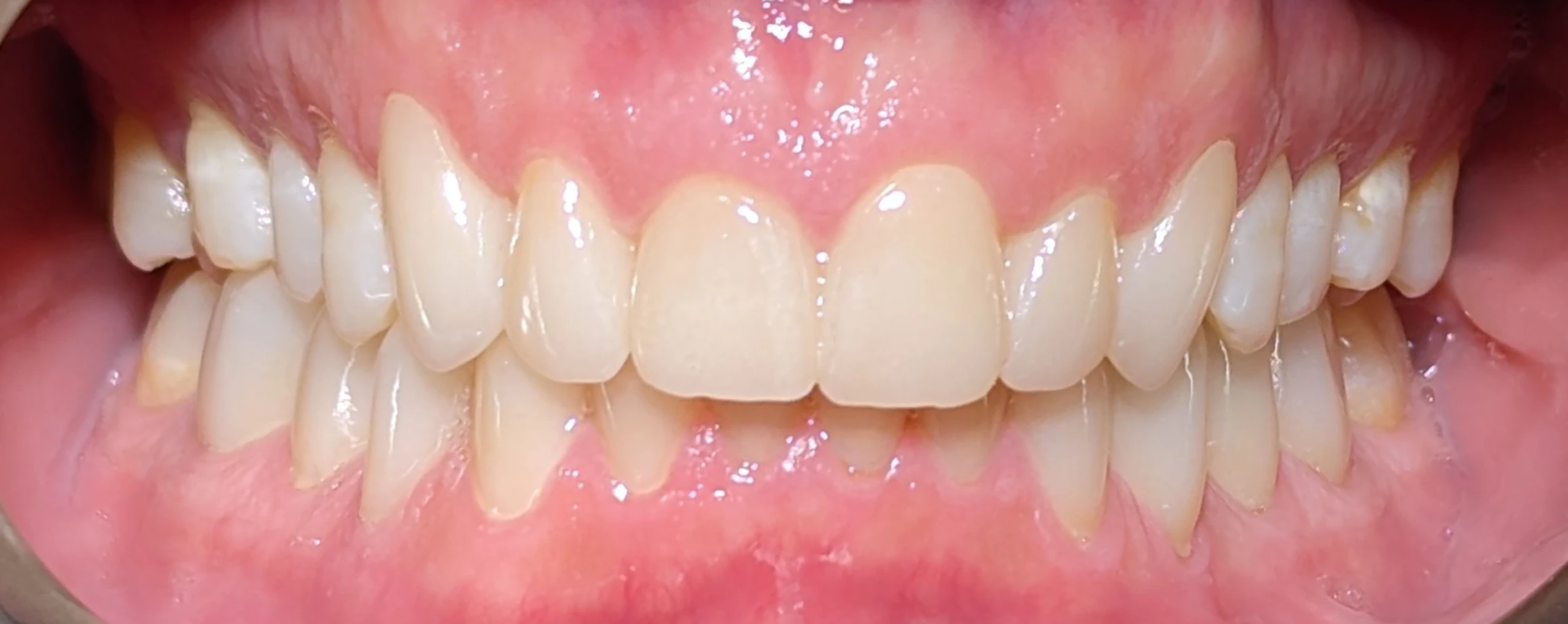 After image