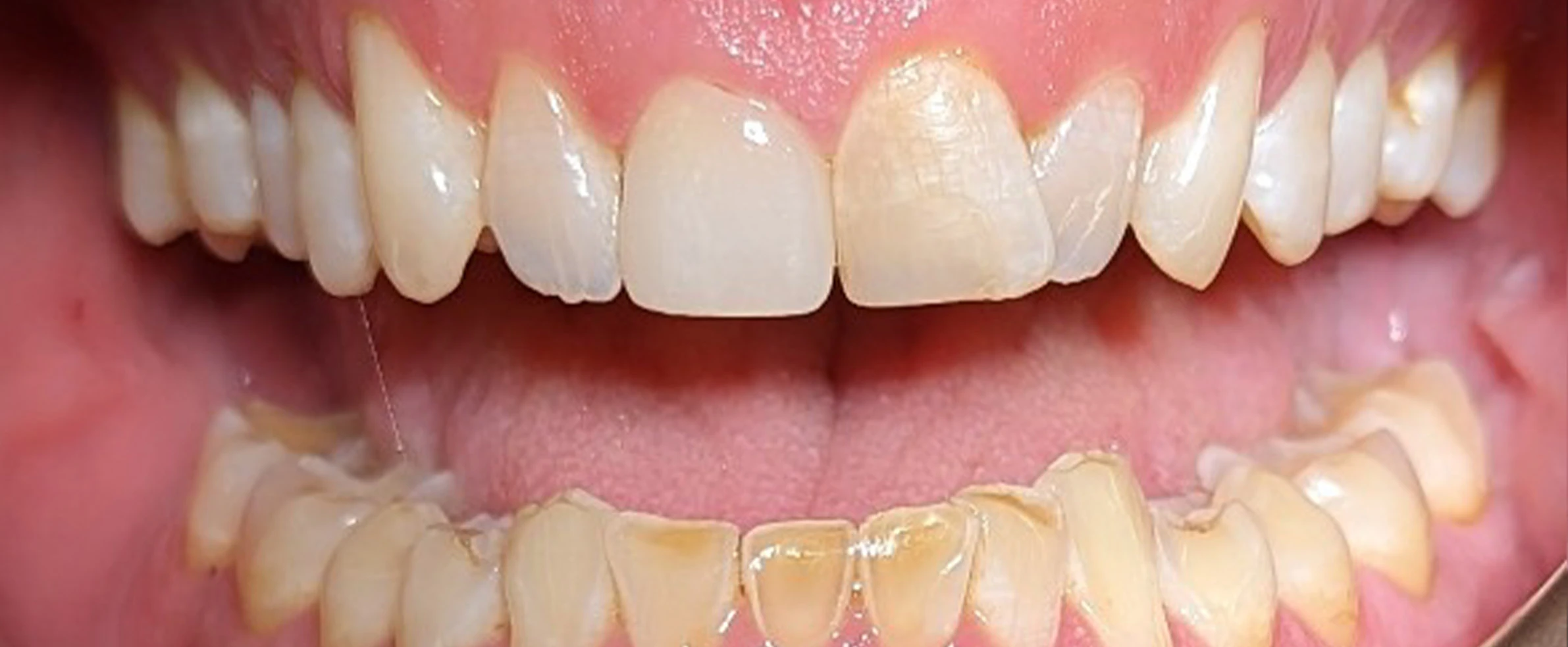 Before image