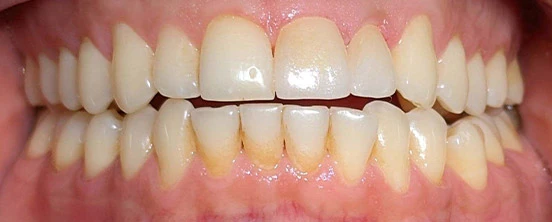After image
