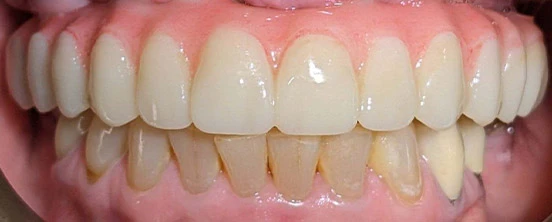 After image
