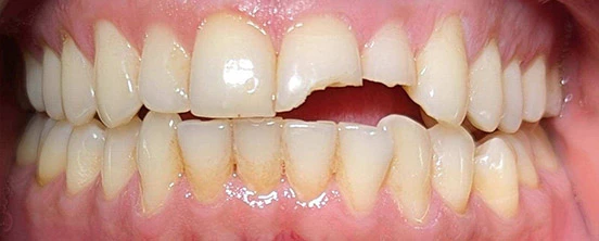 Before image