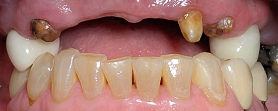Before image