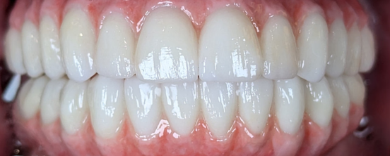 After image
