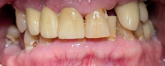 Before image