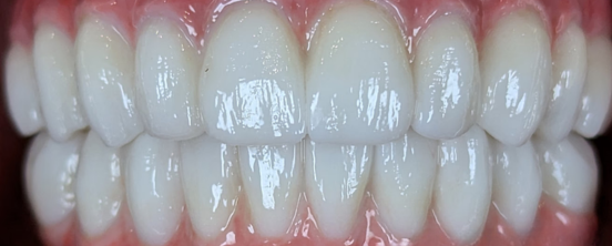 After image