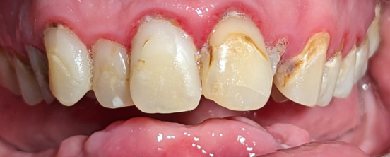 Before image