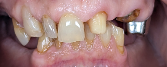 Before image
