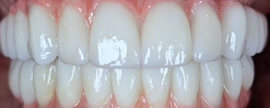 After image