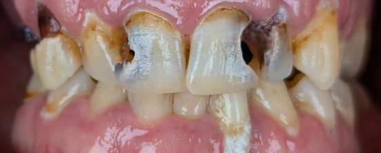 Before image