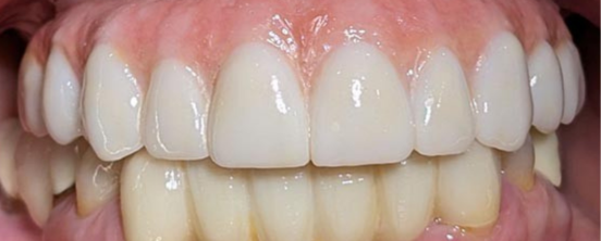 After image