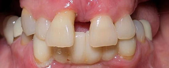 Before image